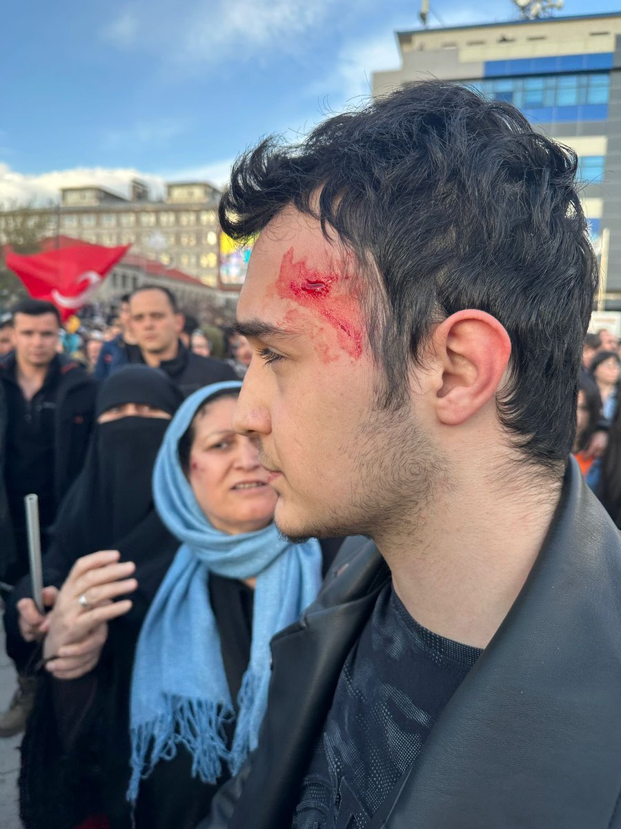 Muharrem Bey, Sinan Bey, seçimi neden ilk turda bitirmemiz , ikinci tura bırakmamamız gerektiğini  “sandığı mezar edeceğiz” “vücutlarına mermi alırlar” tehditlerine rağmen anlamadıysanız belki bugün taşlanan bu genç arkadaş anlamanızı sağlar. Çözümün bir parçası değiseniz sorunun