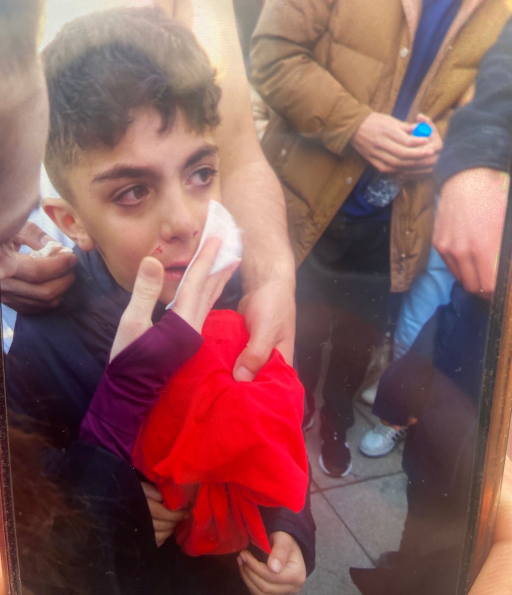 solcugazete's tweet photo. Ekrem İmamoğlu'na yapılan saldırıda yaralanan vatandaşlar: https://t.co/LlQi6xuBZt