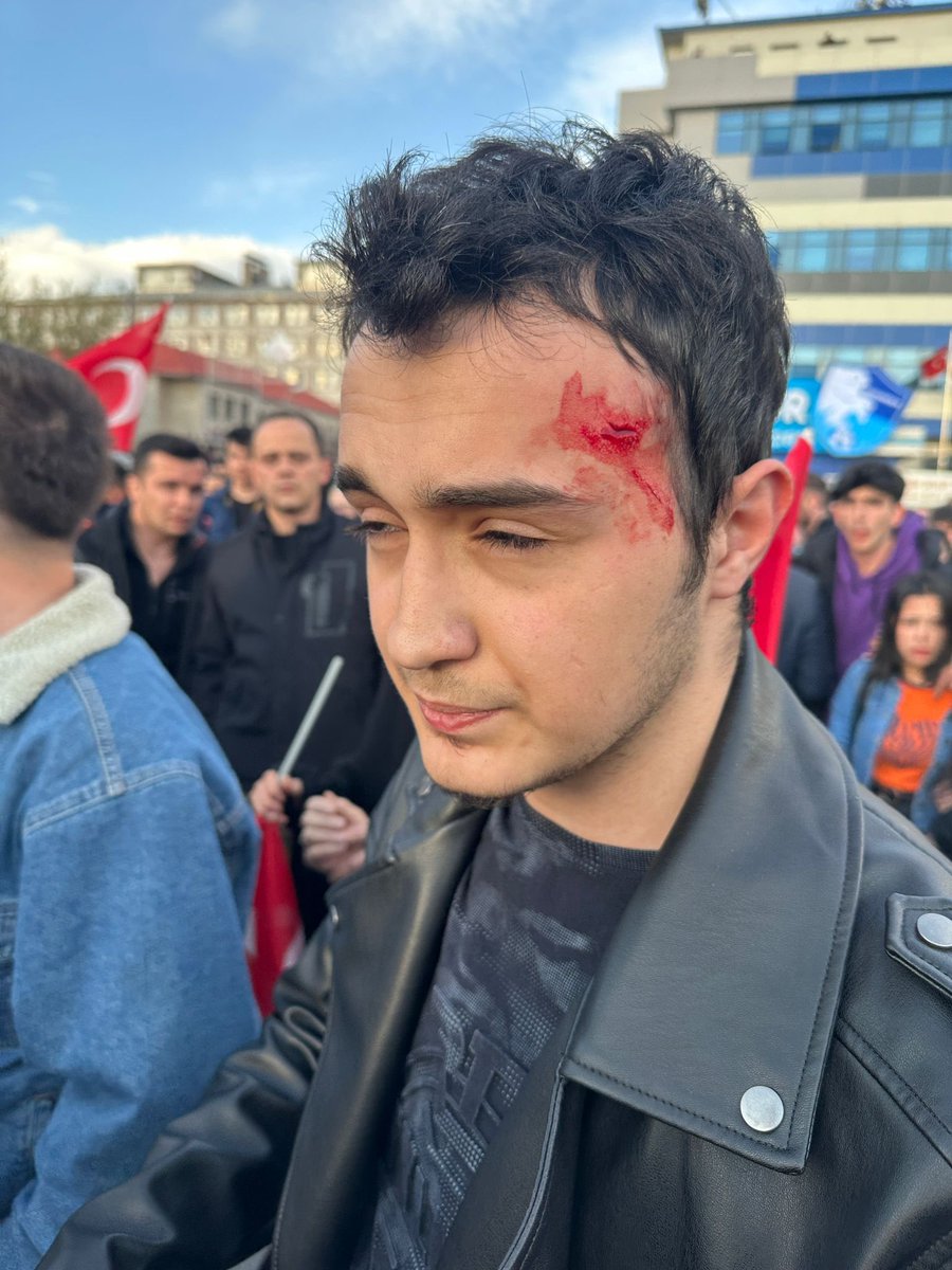 Melek98011331's tweet photo. Ne yapacaklarını şaşırdılar Kan döktüler Ne yaparsanız yapın gideceksiniz Tüm yaralılara geçmiş olsun Acil şifalar dilerim #Erzurum https://t.co/TudTLb3npy