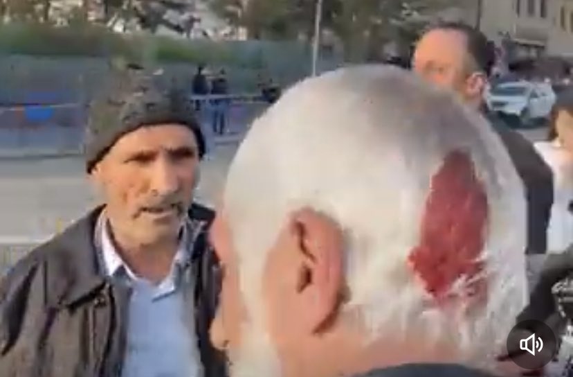 melisalphan's tweet photo. Taşa bakın.
Hepsi ölebilirdi. https://t.co/rdoen9cQi9