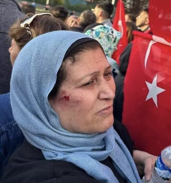 melisalphan's tweet photo. Taşa bakın.
Hepsi ölebilirdi. https://t.co/rdoen9cQi9