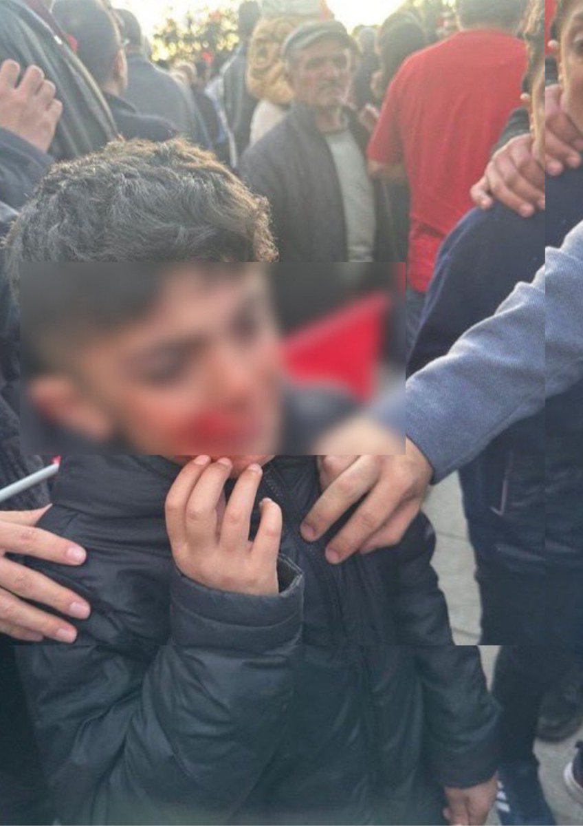 ErcmentAkdeniz's tweet photo. Faşizme  geçit yok!
Tek adam düzeni bitecek. 
Birleşe birleşe kazanacağız.
Şu çocuğun gözyaşlarına yenileceksiniz! https://t.co/970Zv9B0gc