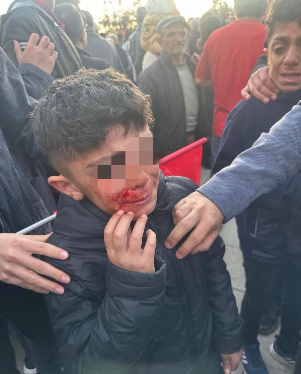 #Erzurum'da Ekrem İmamoğlu'na ve vatandaşlarımızla birlikte bu küçük yavrumuza yapılan şiddeti kınıyorum! Seçimler bu ülkede 100 yıldır demokrasi şenliğidir. Demokrasimize atılan o taşların sorumlularının en ağır şekilde cezalandırılması ve bir daha böyle olaylar yaşanmamasını
