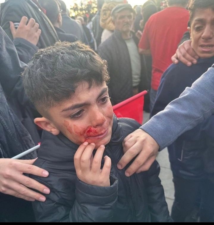 Özgürlük mücadelesi bedel ister biz bedel vermeye hazırız ..
#ilkturdabitirelim ..
<a href="/ekrem_imamoglu/">Ekrem İmamoğlu</a> ..<a href="/kilicdarogluk/">Kemal Kılıçdaroğlu</a>