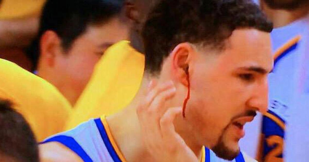 doris burke calling celtics 76ers?