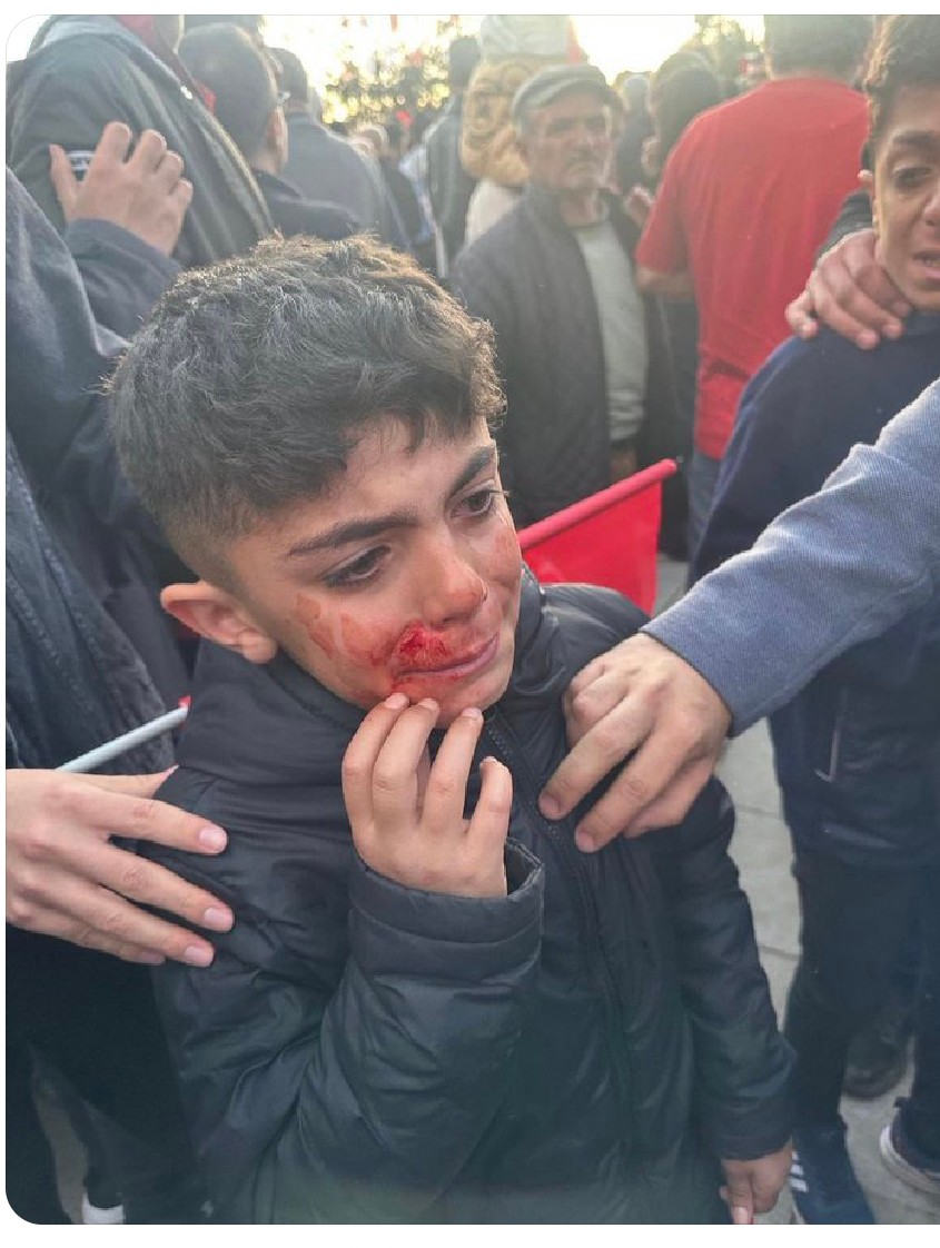 DuvarciSevgi's tweet photo. Çok  geçmiş olsun
#Ekrembaşkan
Bir avuç akli melekelerini yetirmiş zavallılara Erzurum halkı sandıkta çok güzel cevap verecek
@kilicdarogluk  @ekrem_imamoglu @alibabacan https://t.co/xT4pgYbVi9