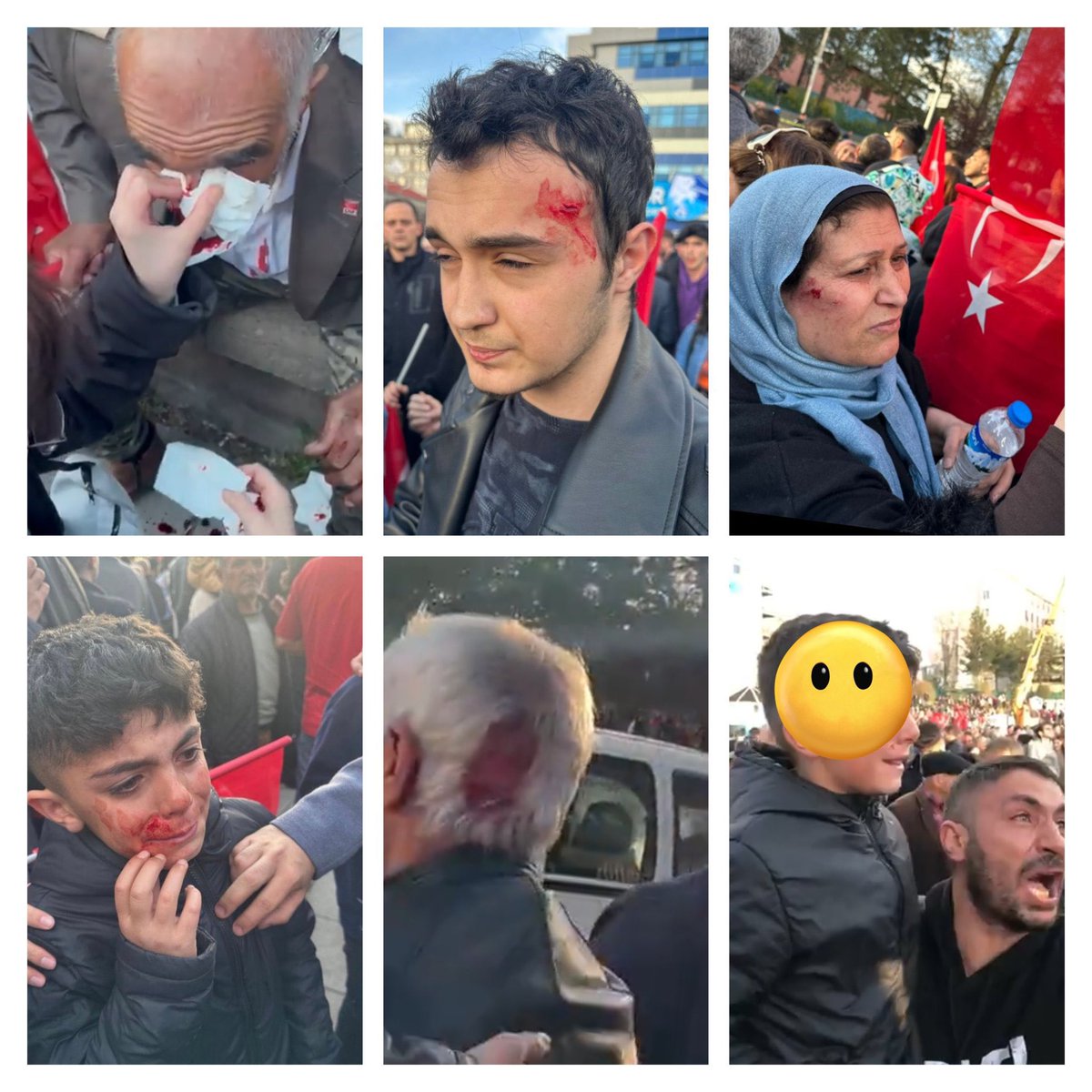 SEÇİMEMİ GİDİYORUZ SAVAŞAMI ANLAMAK ZOR TÜM YOBAZ ZİHNİYETE YAZIKLAR OLSUN.