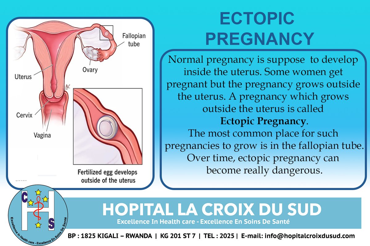 While an #ectopic #pregnancy can not be prevented, it can be treated with medicine if the diagnosis is made 𝐞𝐚𝐫𝐥𝐲.  Visit your Doctor early .... Book an appointment at hopitalcroixdusud.com #Gynecology #health #pregnancyjourney #pregnancy #obstetrics