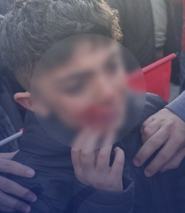 sercanal's tweet photo. Korkmayın!
İyilik, bu kötülüğü bitirecek!!! https://t.co/pBqTPLMOkJ