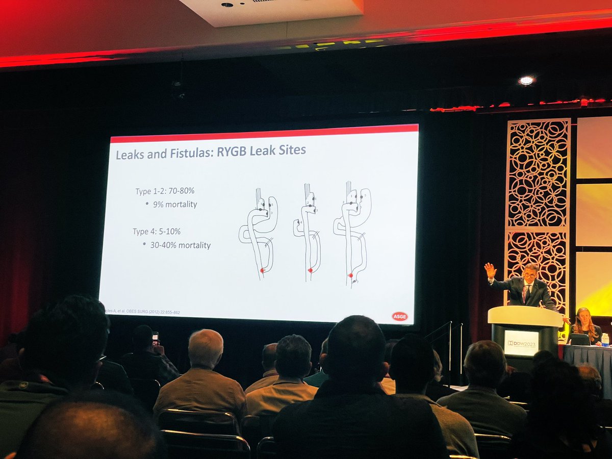 Amit Grover, MD (@pancreas_md) on Twitter photo #HIGHFIVES all around as <a href="/MetabolicEndo/">Chris Thompson, MD</a> gives a thorough and super informative talk on the complications seen in #bariatricsurgery during a great session moderated by <a href="/allie_schulman/">Allison Schulman MD, MPH</a> at the <a href="/ASGEendoscopy/">ASGE GI Endoscopy</a> postgrad course #DDW2023 #HIGHFIVES all around as <a href="/MetabolicEndo/">Chris Thompson, MD</a> gives a thorough and super informative talk on the complications seen in #bariatricsurgery during a great session moderated by <a href="/allie_schulman/">Allison Schulman MD, MPH</a> at the <a href="/ASGEendoscopy/">ASGE GI Endoscopy</a> postgrad course #DDW2023