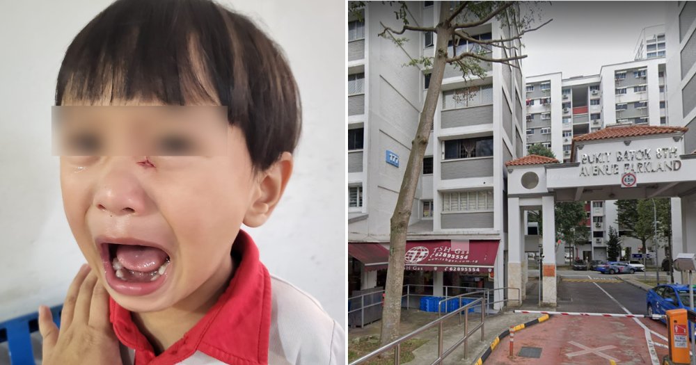 MothershipSG's tweet photo. Woman on PMA delivering food in Bukit Batok hits boy, 2, speeds off without apology https://t.co/EnbzxwKJaM https://t.co/LhK1iJufFL
