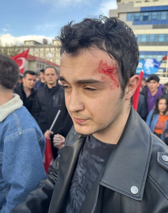 savashaberjp's tweet photo. 【トルコ総選挙】「全てが今よりずっと美しくなる」（HER ŞEY ÇOK GÜZEL OLACAK）合言葉の野党の集会に攻撃。候補者の命を狙おうとして暴れたようだ。

#Secim2023 #TurkiyeSanaEmanet #Erzrum https://t.co/UMNQl0luL7
