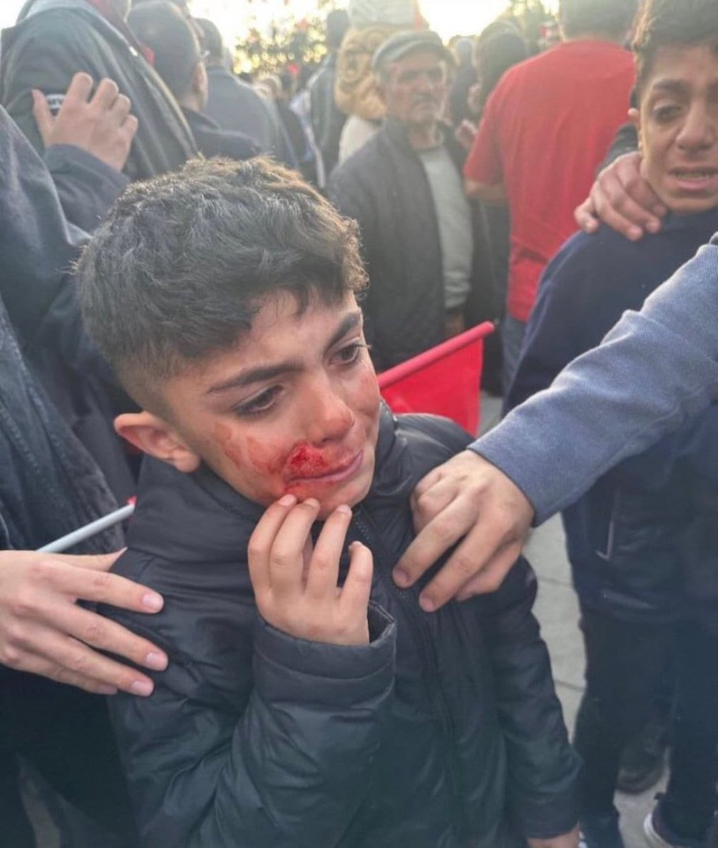 oftopcuoglu's tweet photo. Dadaşların alnına leke çalan bu bir avuç çapulcuya en güzel cevabı 14 Mayısta vereceğiz. Erzurumlular olarak bu lekeyi temizleyeceğiz. Tüm provakasyonlara karşı, organize kötülüklere karşı umutla #herseycokguezelolacak diyoruz. 

#ilkturdabitirelim https://t.co/IvtYPoAzv4