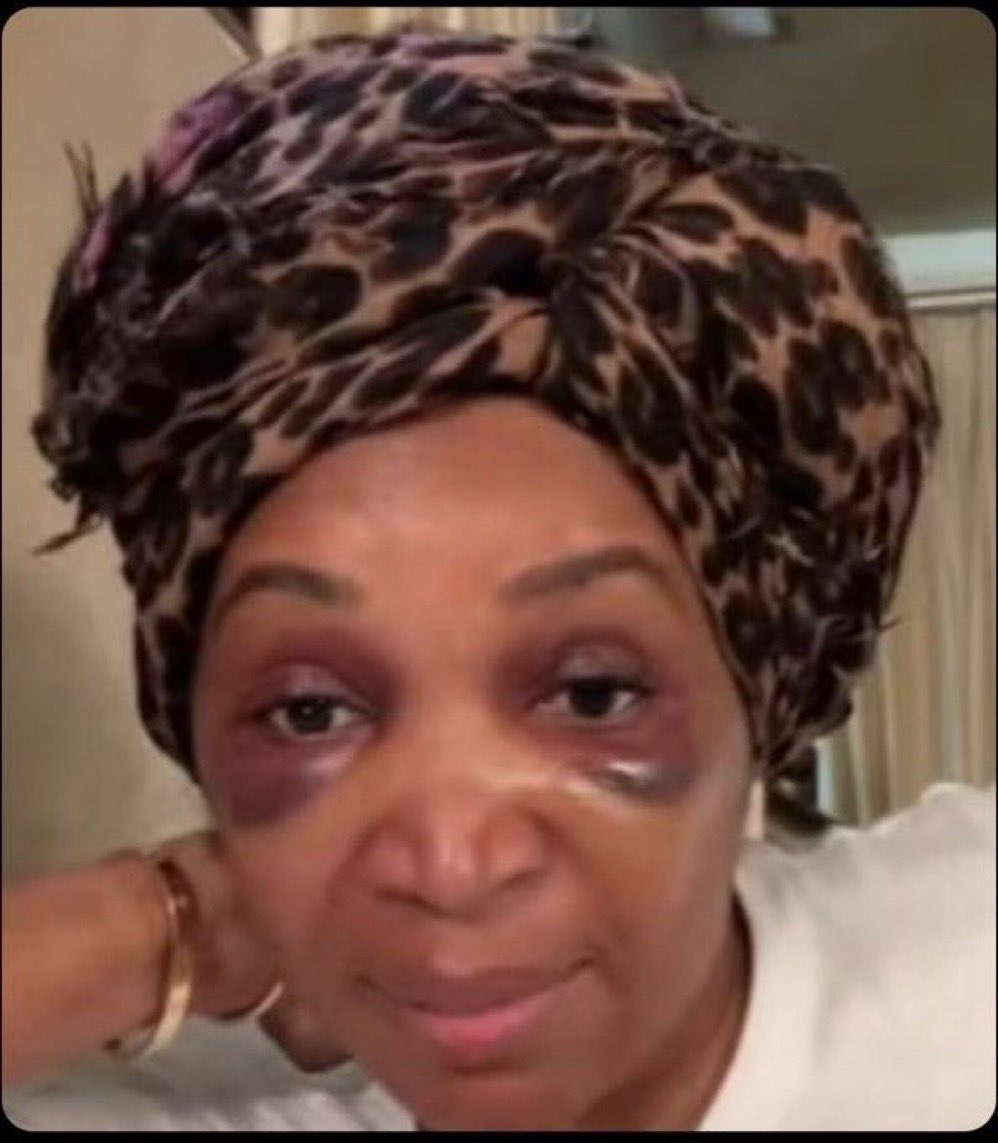 lworkyourgifts's tweet photo. Kandi got a KFC commercial and Marlo got NOTHING! #RHOA https://t.co/fzgaTPoO4u