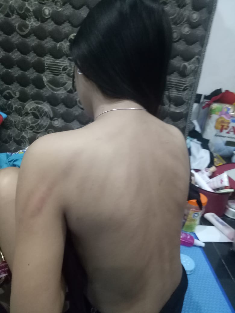 missluuluk1's tweet photo. Bekas tattoo jawa https://t.co/oVSRQPqMVX