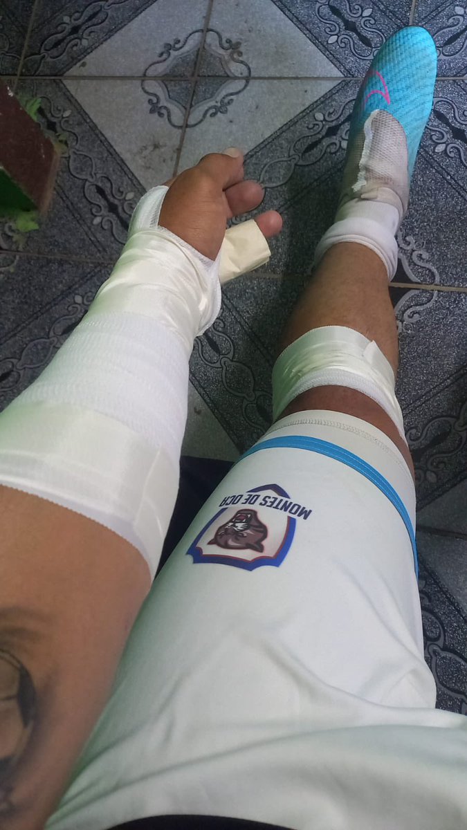De Santa no hicimos reporte médico porque está hecho de perling… a pesar de que lo chocaron en moto a mitad de semana así jugó hoy nuestro central 🫡 Otro día en la oficina 😴