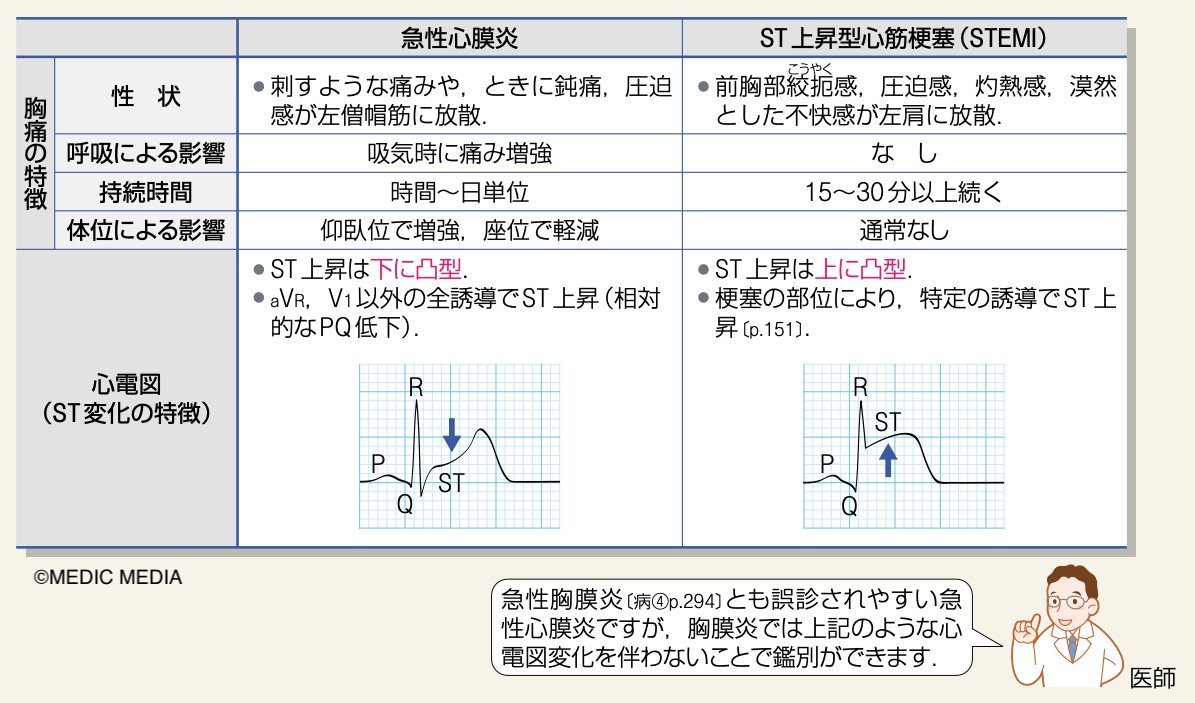 心電図による心筋梗塞の鑑別診断 病気がみえる on X: 