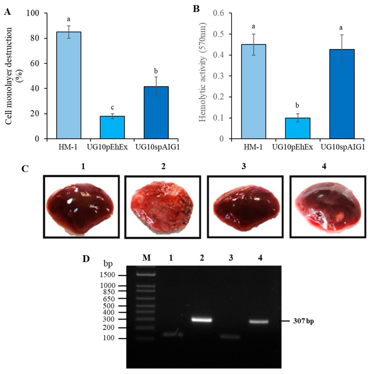 Pathogens_MDPI's tweet photo. 📢 Attenuation of In Vitro and In Vivo #Virulence Is Associated with Repression of #Gene Expression of AIG1 Gene in #Entamoeba histolytica
👨🎓 by Janeth Lozano-Mendoza et al. @UdeGuanajuato @UTokyo_News_en
🔗 Full article: https://t.co/SJzSNfI0SX
#transcriptome https://t.co/GwuiG1taGw