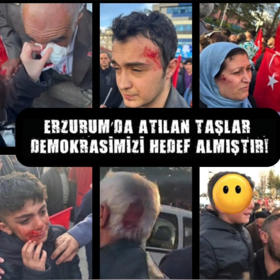 Erzurum' da miting alanında vatandaşımıza ve Ekrem İmamoğlu 'na atılan taşlar demokrasiye atılmış taşlardır. Şiddetin her türlüsüne karşıyız. Yaralanan vatandaşlarımıza şifalar diliyor, bu yapılan saldırıyı kınıyoruz. 
Adalet! Adalet! Adalet!
#Erzurum