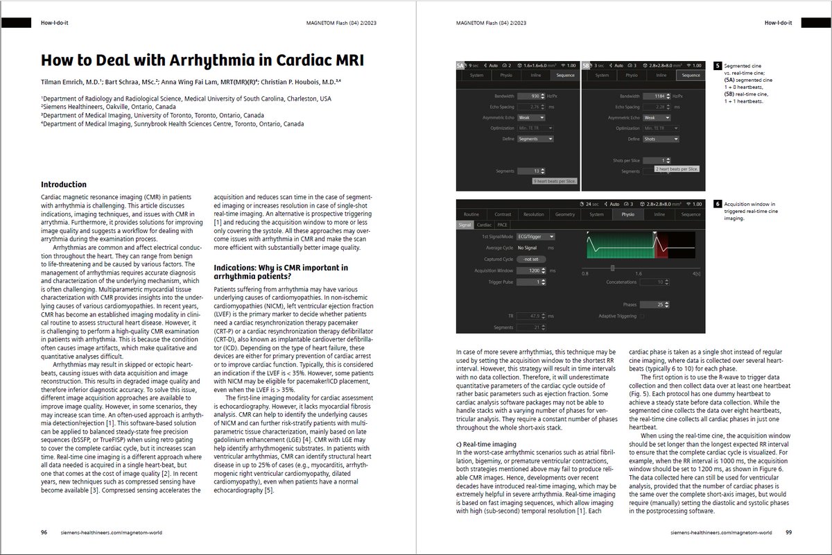 How to Deal with #Arrhythmia in Cardiac #MRI.  @Houbi_Radiology (@imagingtoronto, @Sunnybrook); @TilmanEmrich (@MedUnivSC); et al. provide solutions for improving image quality and suggest a workflow for dealing with arrythmia at …ng.webassets.siemens-healthineers.com/59085054a42437…
#magnetomworld #CMR