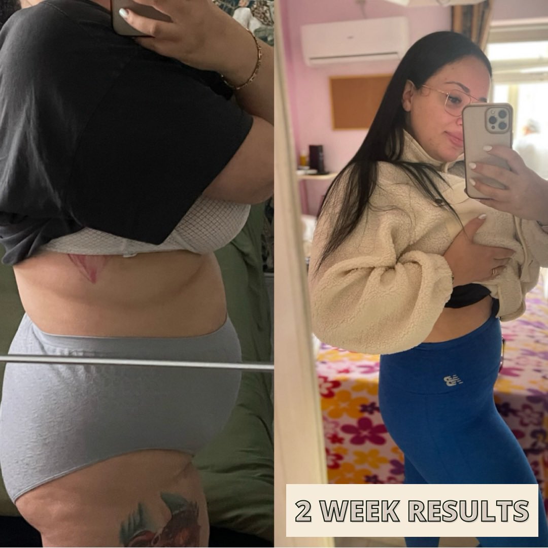 Tamzin_Thornton's tweet photo. ✖️ 𝐏𝐑𝐎𝐃𝐔𝐂𝐓 𝐓𝐄𝐒𝐓𝐄𝐑𝐒 𝐖𝐀𝐍𝐓𝐄𝐃 ✖️ - The best seller within our team is the 𝐓𝐑𝐈𝐎 𝐎𝐅 𝐒𝐏𝐑𝐀𝐘𝐒! Here’s how it works;
3 pocket size sprays that work perfectly together to; speed up metabolism,Help suppress appetite so you feel fuller and crave/snack less https://t.co/kZETLkXWJB