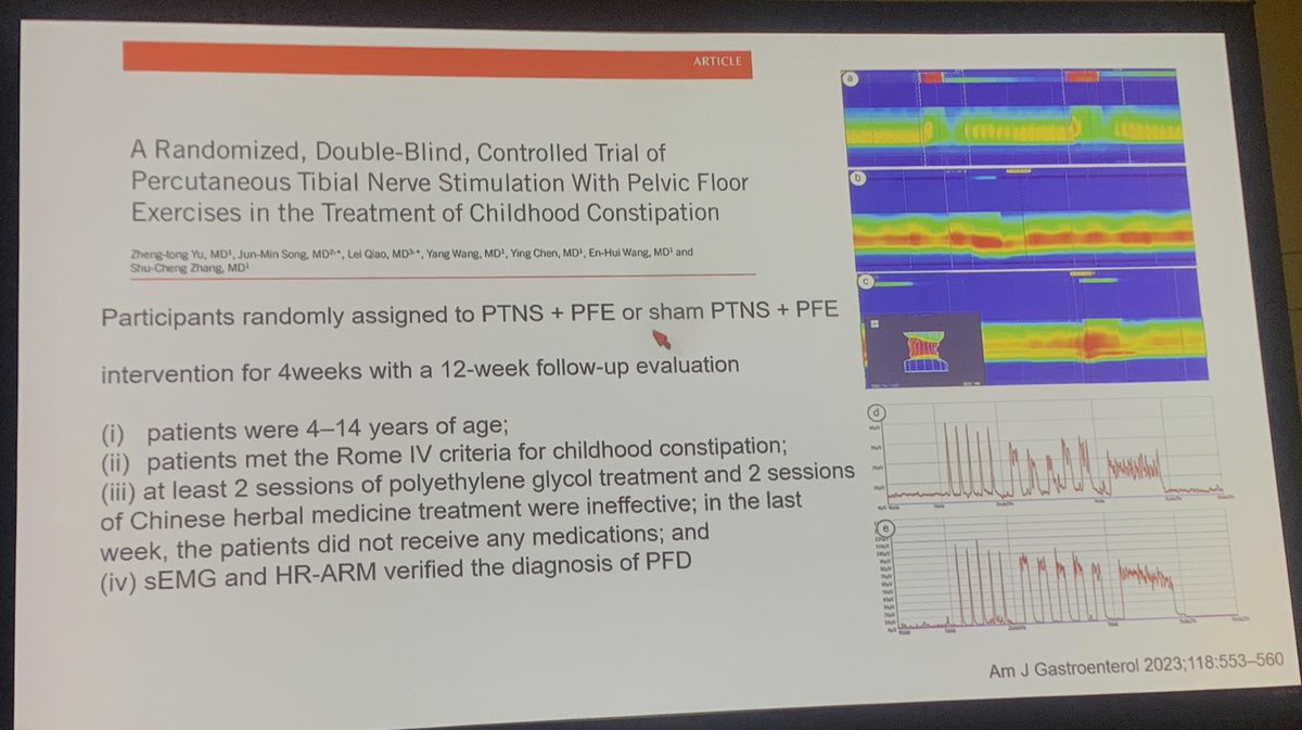 NeeraGuptaMD's tweet photo. Dr Nikhil Thapar giving the Pediatric Functional &amp; #Motility Disorders #Research Year in Review #DDW2023 #PGDB https://t.co/CsswVqTOFL
