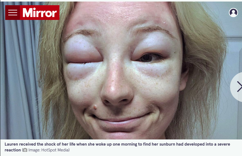 Chris Turnbull on Twitter "They look like these pictures I'm attaching