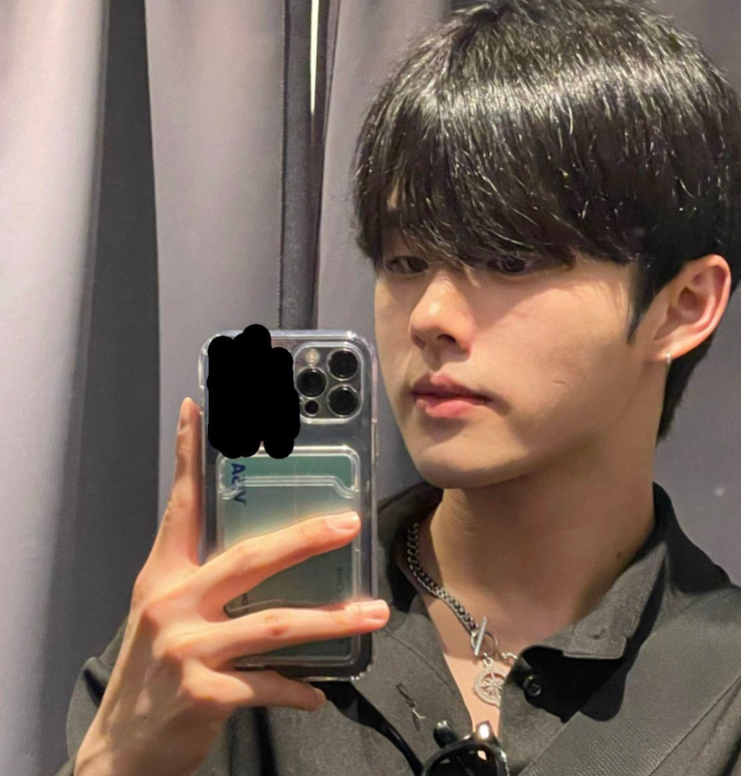 SoonplusJ's tweet photo. 【SOONPLUS整形外科】症例写真
手術内容: #リジュランヒーラー
⭐️傷ついた肌を細胞の中から再生
⭐️肌の根本から変えるサーモン注射
⭐️輝いている私を記憶する
公式LINE👉@776lgakf
#SOONPLUS整形外科 #スーンプラス #韓国整形 #韓国美容整形 #整形外科 https://t.co/06m3ucncCE