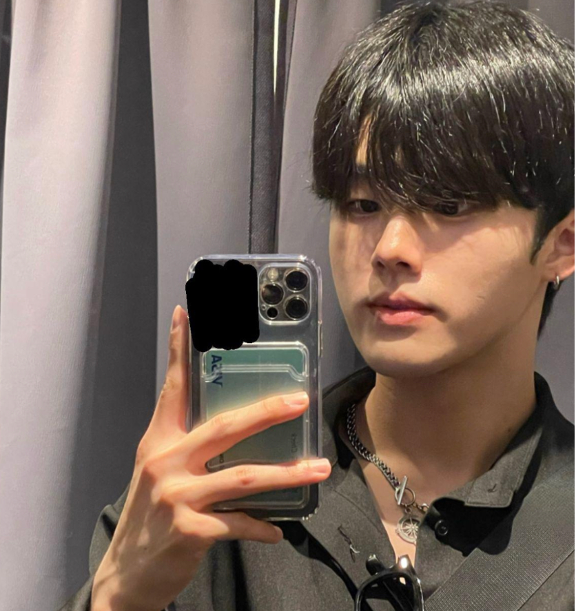 SoonplusJ's tweet photo. 【SOONPLUS整形外科】症例写真
手術内容: #リジュランヒーラー
⭐️傷ついた肌を細胞の中から再生
⭐️肌の根本から変えるサーモン注射
⭐️輝いている私を記憶する
公式LINE👉@776lgakf
#SOONPLUS整形外科 #スーンプラス #韓国整形 #韓国美容整形 #整形外科 https://t.co/06m3ucncCE