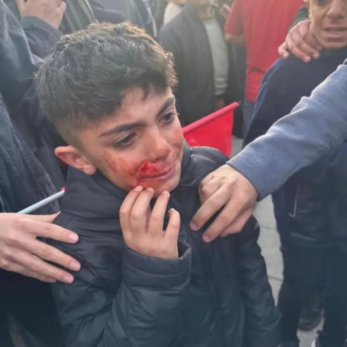 SAVBES1's tweet photo. Erzurum’da Ekrem İmamoğlu’na yapılan faşist ve ırkçı saldırıyı kınıyoruz. 
Daha fazla gerginlik, kutuplaşma, düşmanlık ve çatışma üreten politikaları, dili ve üslubun derhal bırakılması gerekmektedir. Geçmiş olsun.
Sav-Bes Genel Merkezi https://t.co/al2wvrKAZr