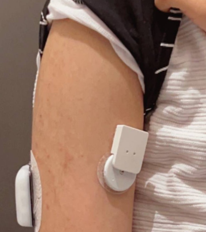 miaomiao_reader's tweet photo. The place is excellent, accurate, and there is no pain in it 👌🏻
@em3_2008 He says depend on it 😍
#freestylelibre #type1diabetic #type1strong #diabeteslife #t2d #miaomiao2 #miaomiao3 #diabetescommunity #diabeticproblems #fuckdiabetes #beyondtype1 #freestylelibrestechnology https://t.co/ZjFqwmIgQW