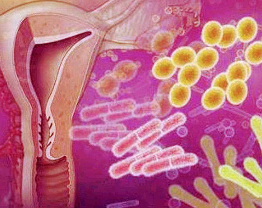 Microbiota vaginale e medicina riproduttiva. Read More👇linkedin.com/pulse/microbio… #dianayedid <a href="/dydmedicinaint/">dyd medicina int</a>
#microbiotavaginale #medicinariproduttiva