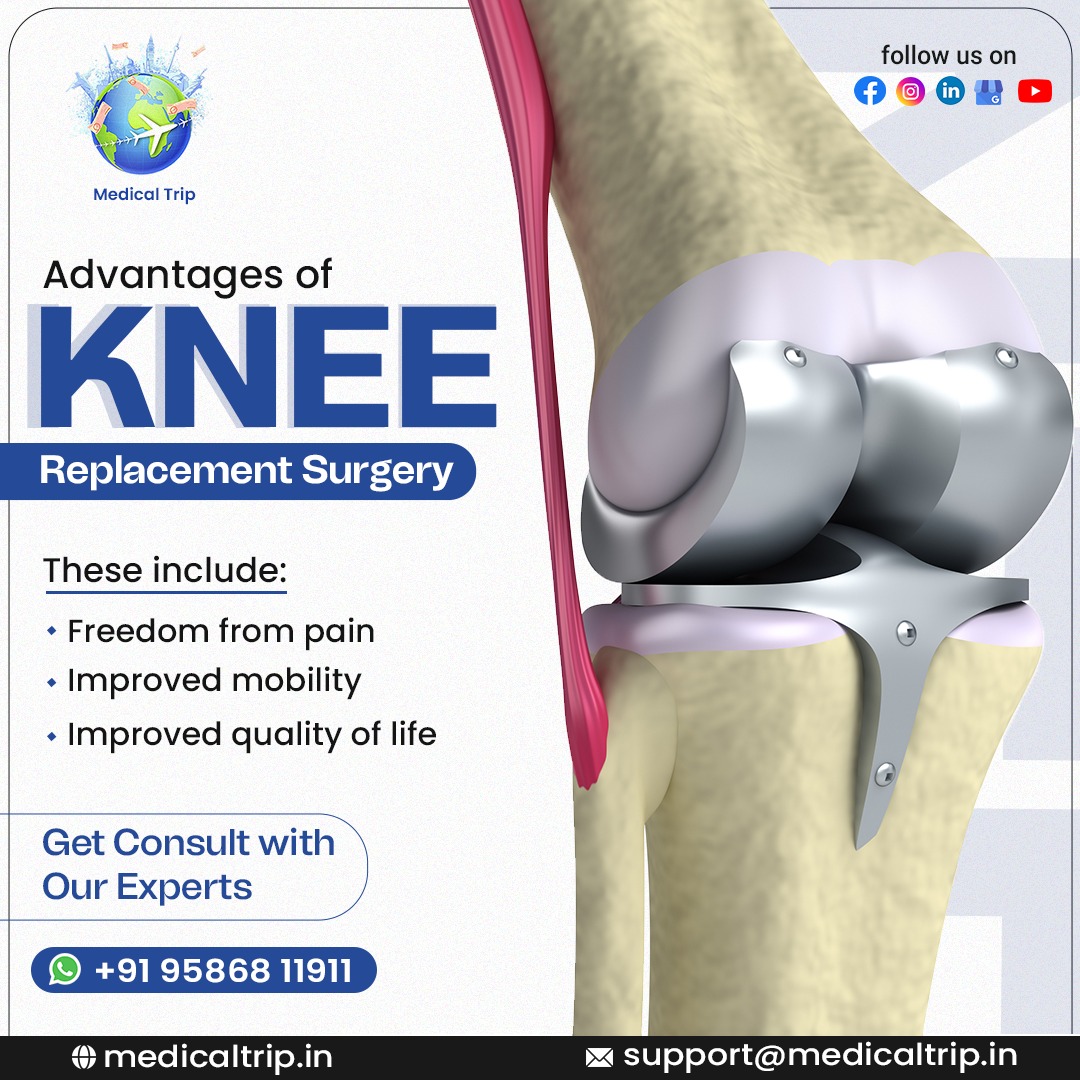 Medicaltrip2023's tweet photo. Advantages of Knee Replacement
📷Freedom from pain
📷Improved mobility
📷Improved quality of life
Reach us and get a free quote.
Contact Us:
📷 +91 9586811911
📷 support@medicaltrip.in
Visit us: https://t.co/byX090Y2Tj
#heart #heartpain #chest #chestpain #medicaltrip https://t.co/Irrd8d0NPZ
