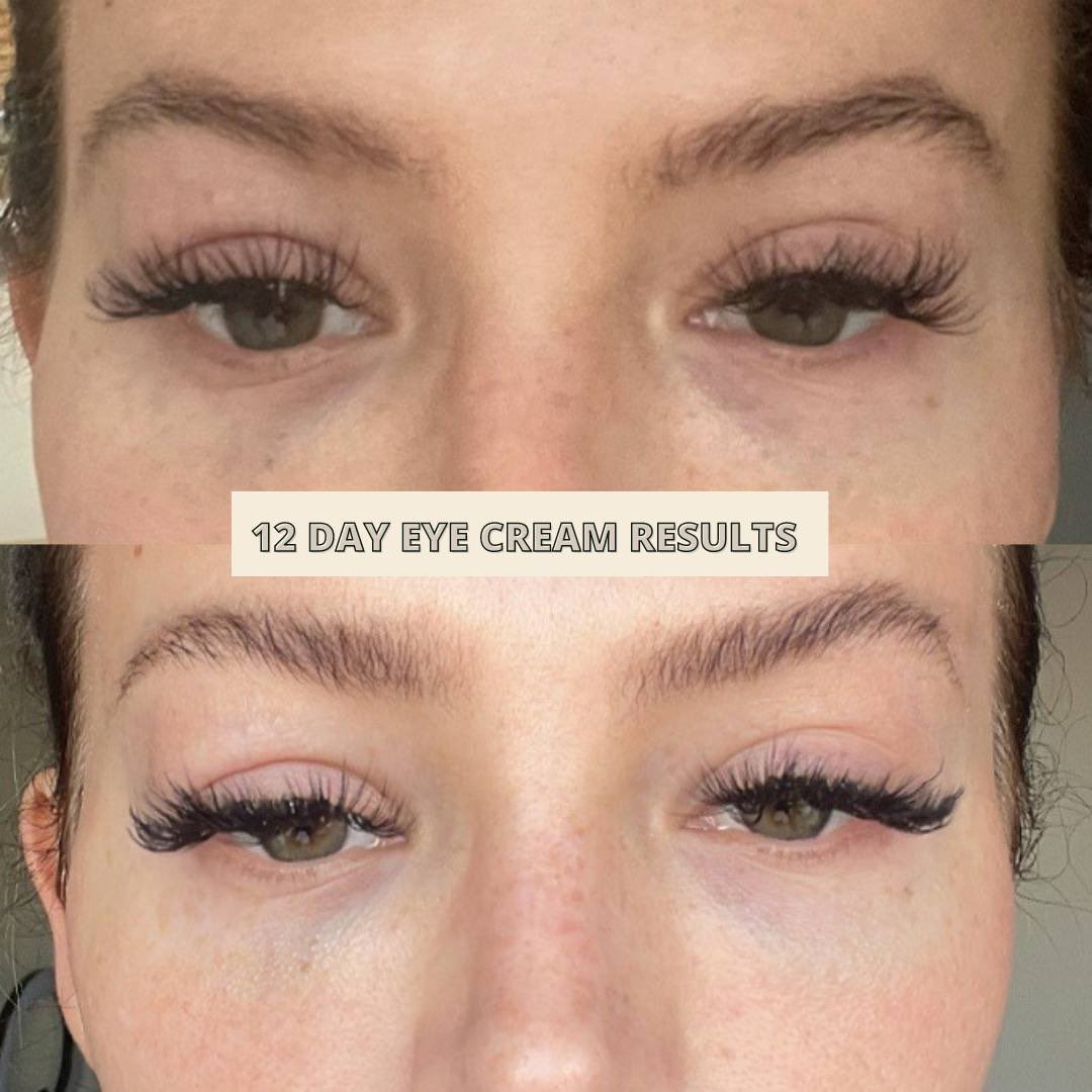Tamzin_Thornton's tweet photo. ✖️ LETS TALK ABOUT COLLAGEN
I cannot recommend this enough 60 𝐃𝐀𝐘 𝐌𝐎𝐍𝐄𝐘 𝐁𝐀𝐂𝐊 𝐆𝐔𝐀𝐑𝐀𝐍𝐓𝐄𝐄
Collagen benefits including; helping reduce signs of ageing ✔️ reducing the appearance of open pores &amp; scaring ✔️ plumping the skin &amp; giving a glow ✔️ hair &amp; nail growth ✔️ https://t.co/p3eRRr7Zyx
