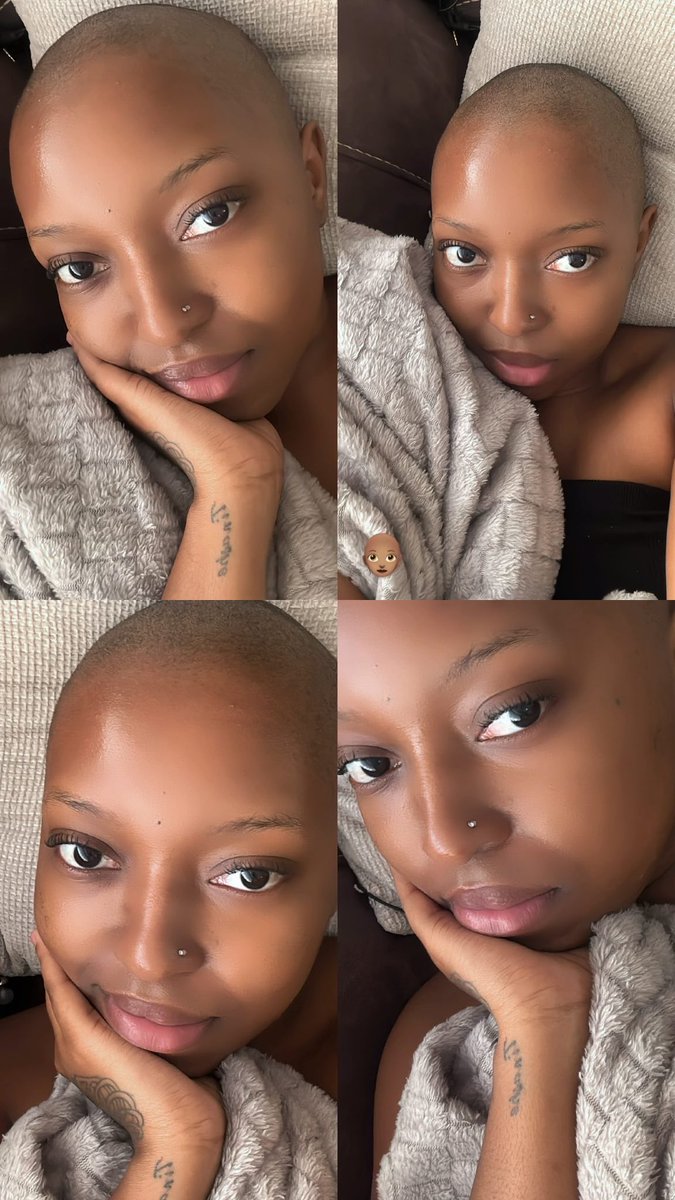tbaitshepi_'s tweet photo. Woke up and decided I wanted to be bald today https://t.co/Q17URAE9Qo