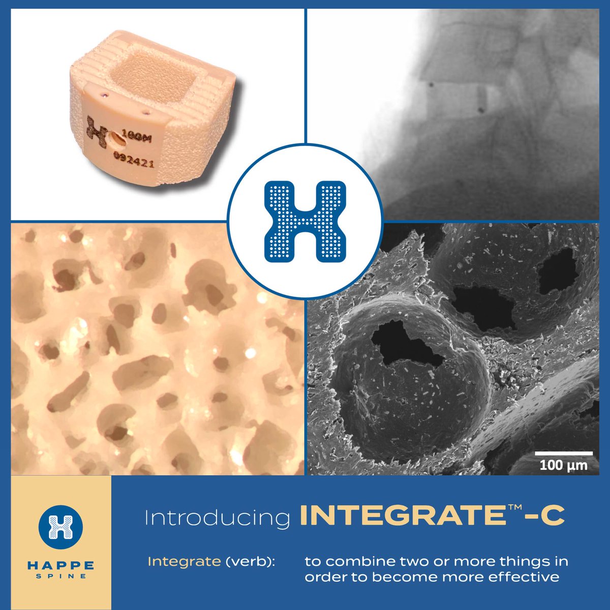 GenesisGroup_MI's tweet photo. HAPPE Spine Announces FDA Clearance for the INTEGRATE-C™  Interbody Fusion System

https://t.co/adG9RR44V2 https://t.co/FCptbY3Qal