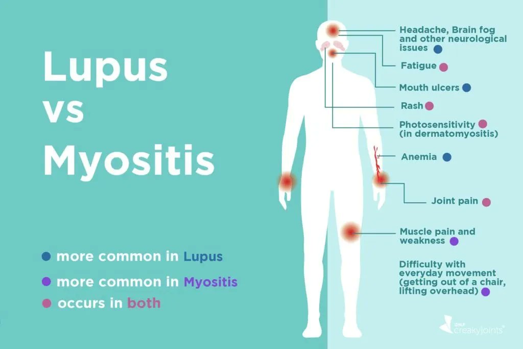 #LupusAwarenessMonth and #MyositisAwareness Month are both in May