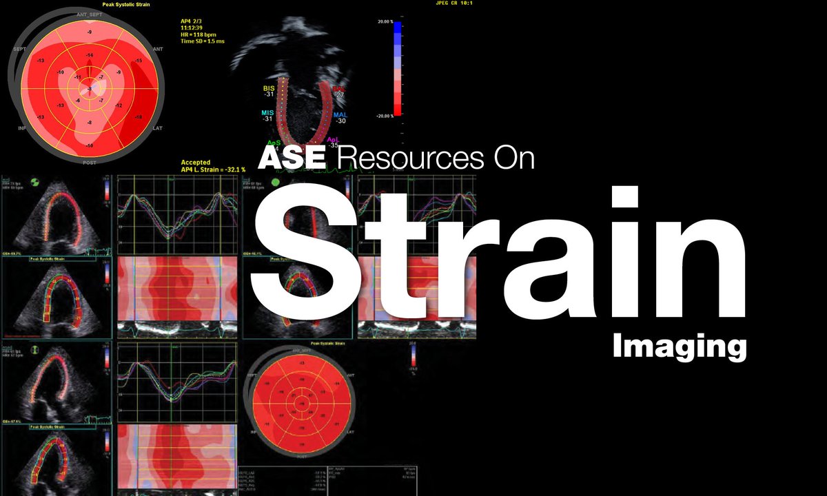 American Society of Echocardiography (@ase360) on Twitter photo Explore <a href="/ASE360/">American Society of Echocardiography</a>'s Strain Imaging Resources web page! bit.ly/3W6EhaX The resources page features:
❤️ Webinars
❤️ Guidelines
❤️ Articles
❤️ Cases
❤️ Videos Explore <a href="/ASE360/">American Society of Echocardiography</a>'s Strain Imaging Resources web page! bit.ly/3W6EhaX The resources page features:
❤️ Webinars
❤️ Guidelines
❤️ Articles
❤️ Cases
❤️ Videos