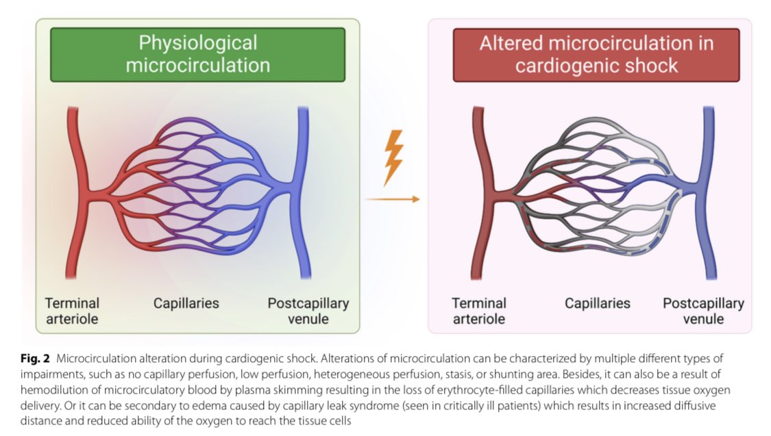 Vanessa S. Lanziotti (@vslanziotti) on Twitter photo Great review about Microcirculatory dysfunction in cardiogenic shock.
❗️Mortality & outcomes in 🫀 shock are strongly assoc. w/ microcirculation disorders that are not necessarily correlated w/ macrocirculation.
#PedsICU #sepsis #FOAMed #FOAMcc #MedEd
annalsofintensivecare.springeropen.com/articles/10.11… Great review about Microcirculatory dysfunction in cardiogenic shock.
❗️Mortality & outcomes in 🫀 shock are strongly assoc. w/ microcirculation disorders that are not necessarily correlated w/ macrocirculation.
#PedsICU #sepsis #FOAMed #FOAMcc #MedEd
annalsofintensivecare.springeropen.com/articles/10.11…