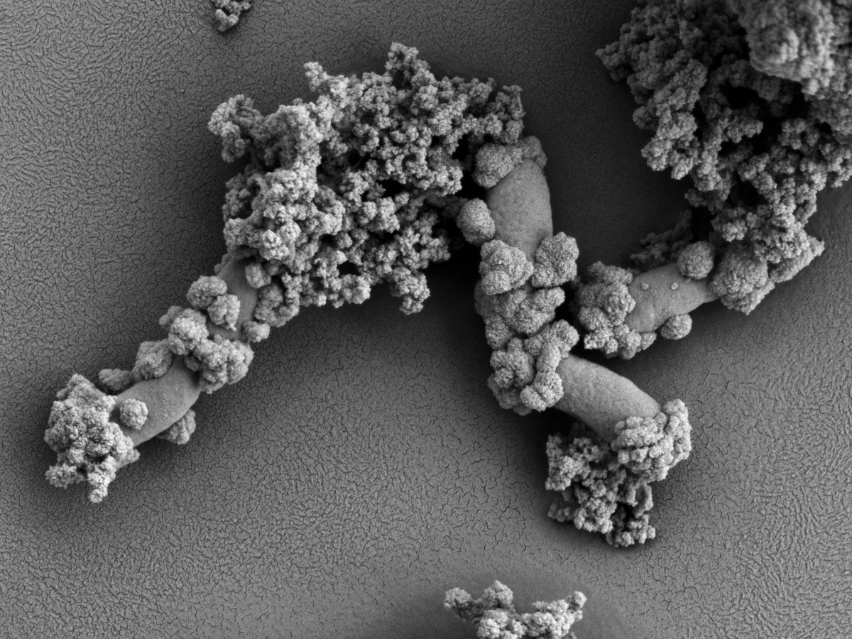 Jeremiah (Jer) Shuster (@jeremiahshuster) on Twitter photo Today's micrograph: A sample of Acidovorax sp. strain BoFeN1, which is an iron(II)-oxidising #bacterium. We can see that iron minerals appear to accumulate on the extracellular surface. This sample was provided by Junjie Zhu.
Fun #SEM times in the @TSM_UniTue and <a href="/GeomicroTueb/">Tuebingen Geomicrobiology</a>. Today's micrograph: A sample of Acidovorax sp. strain BoFeN1, which is an iron(II)-oxidising #bacterium. We can see that iron minerals appear to accumulate on the extracellular surface. This sample was provided by Junjie Zhu.
Fun #SEM times in the @TSM_UniTue and <a href="/GeomicroTueb/">Tuebingen Geomicrobiology</a>.