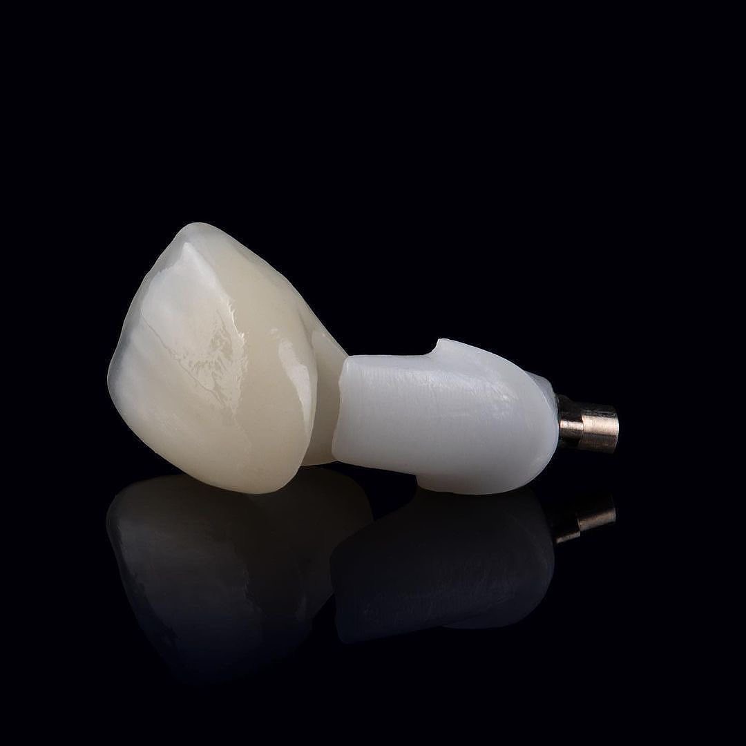 moderndentalCAN's tweet photo. Whether your case requires fixed restorations, removables, or implants, we are here to support your success! Esthetics, fit, and function…our team is equipped to deliver it all! 😁#YourRestorativeEdge

#ModernDentalCanada #DentalLab #DentalImplants #DentalTechnician https://t.co/etajzSaj08