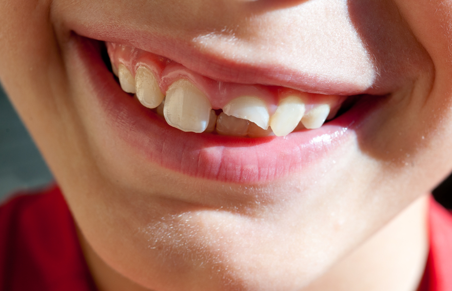 SpringHillsDen's tweet photo. How was your weekend? If you suffered any sort of dental injury, give us a call today so we can get you in quickly for a consultation! https://t.co/yua1vr9K97