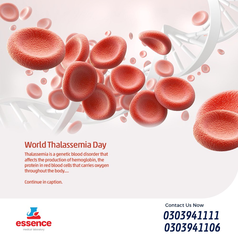 #Thalassemia is a #genetic #blood disorder that affects the production of hemoglobin, the protein in red blood cells that carries #oxygen throughout the body. Individuals with thalassemia have a defect in one or more of the genes that control the production of #hemoglobin.