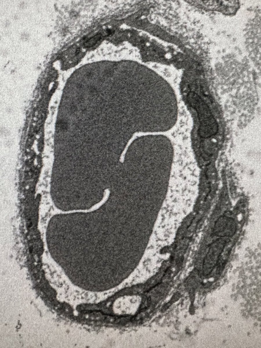 giulia_casal's tweet image. #EM_monday looks like 2 RBCs merged