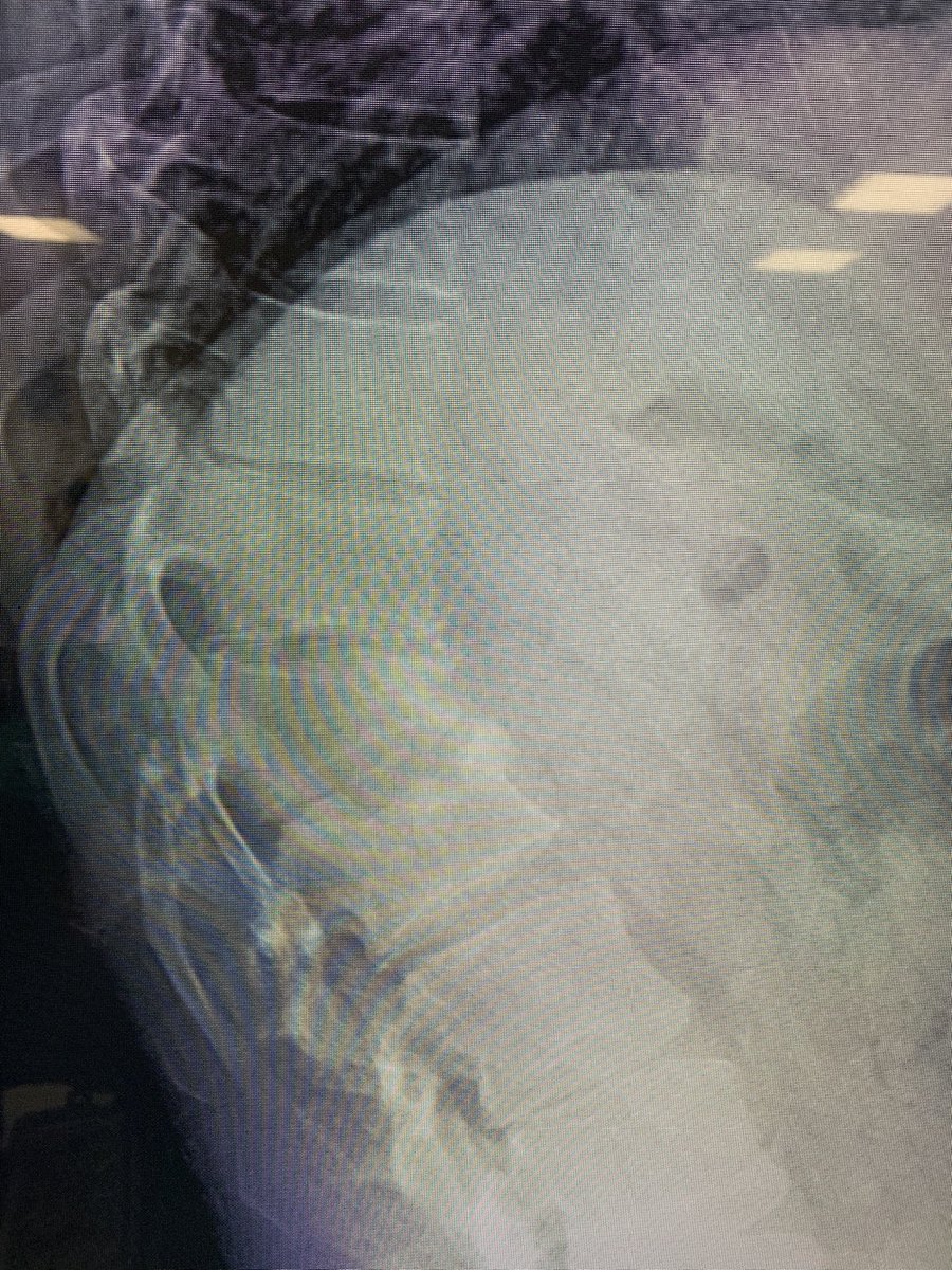 dr_haluk yaka tweet media