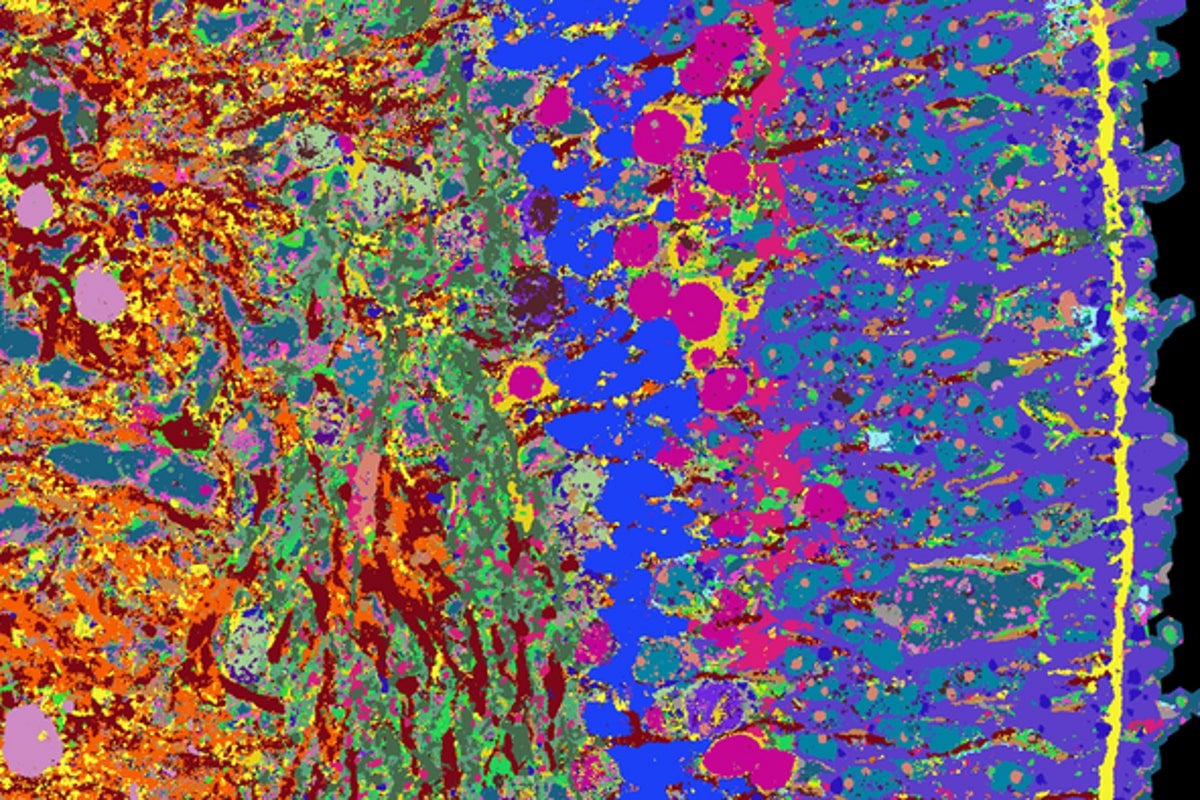NeuroscienceNew's tweet photo. High-Resolution Image of the Human Retina Reveals Stunning Details

Scientists use new 4i technology to visualize 53 different proteins in human retina organoids. The technique provides insights into healthy and diseased tissues and paves the way for creating a detailed human tissue atlas.

Image: Wahle et al. Nature Biotechnology 2023

#neuroscience

https://t.co/a8v2Z2JQ0H