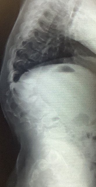 dr_haluk yaka tweet media