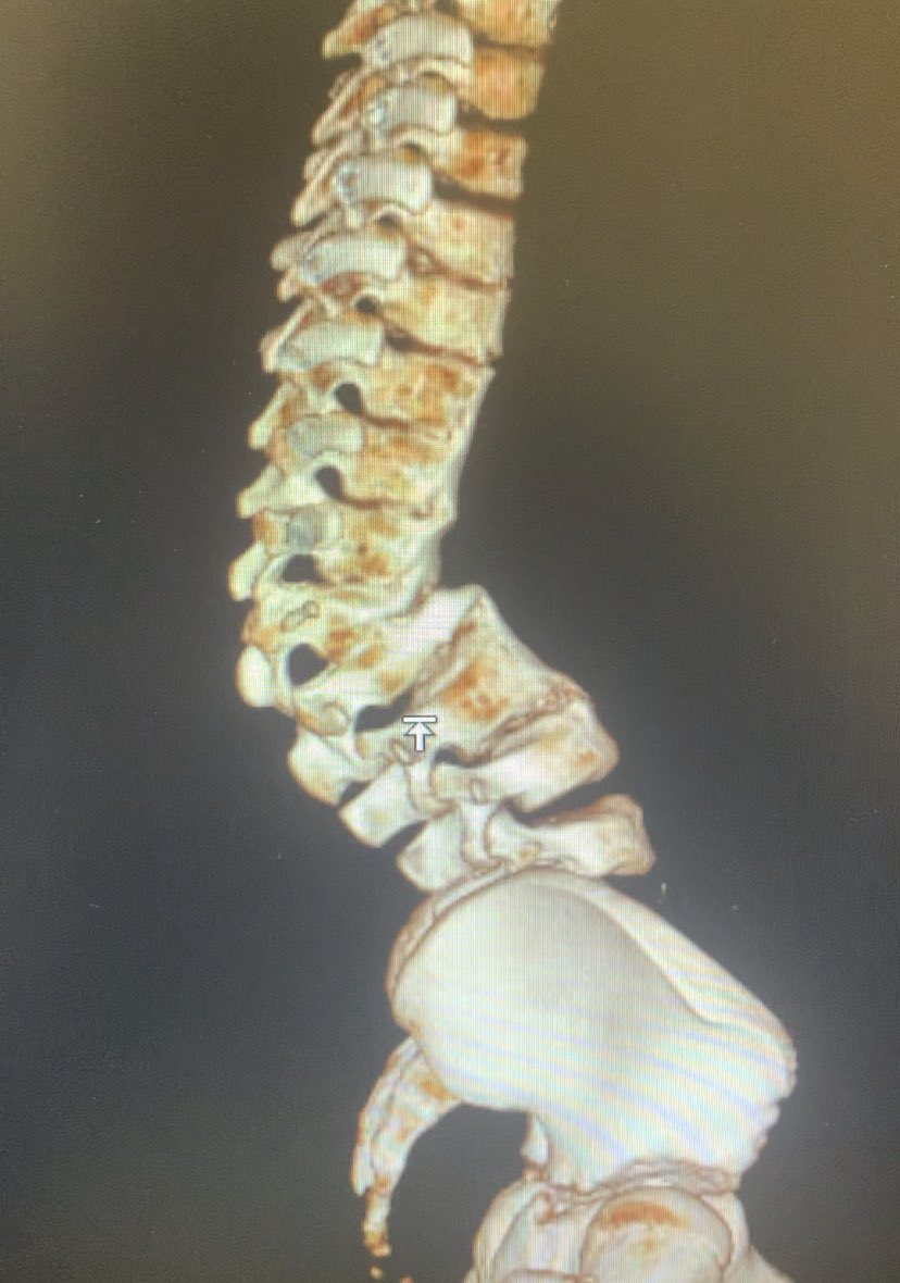 dr_haluk yaka tweet media