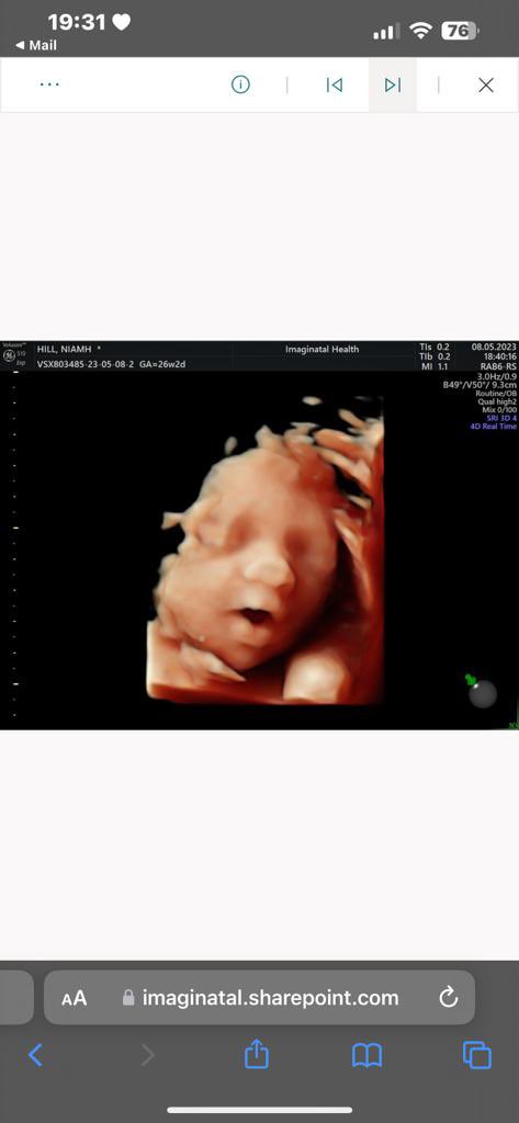 CJ44549's tweet photo. My handsome, happy chatty grandson 💙🥰 I cried https://t.co/qqihym7qpa