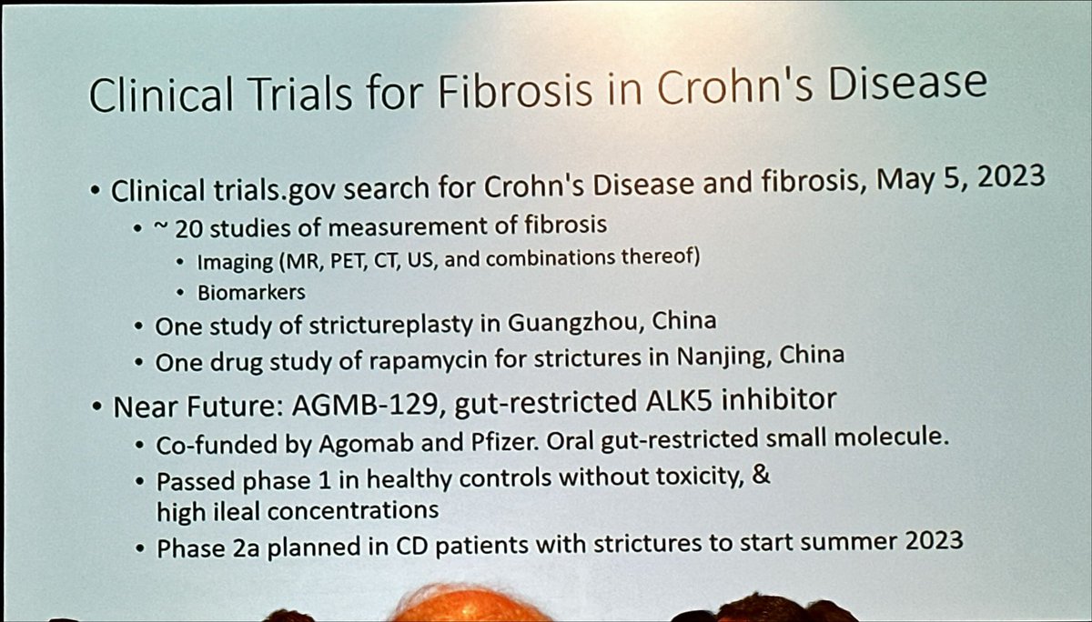 Where are we with targeting fibrosis in CD? Fantastic presentation by <a href="/ibddoctor/">Peter Higgins</a> at #DDW2023 #AGAlive2023 <a href="/DDWMeeting/">Digestive Disease Week</a> #IBD 

- Mechanical therapies how we use them
- Future antifibrotic drugs and challenges
- Lessons from the past and from the future for sure will help us